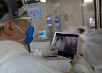 Covid-19: país registra mais de 32 mil casos e 1.305 mortes em 24 horas