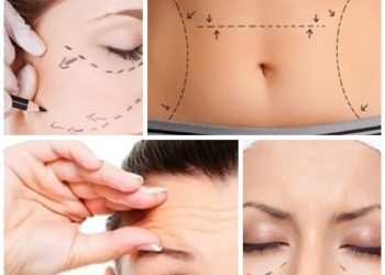 A idade da mulher e a cirurgia plástica