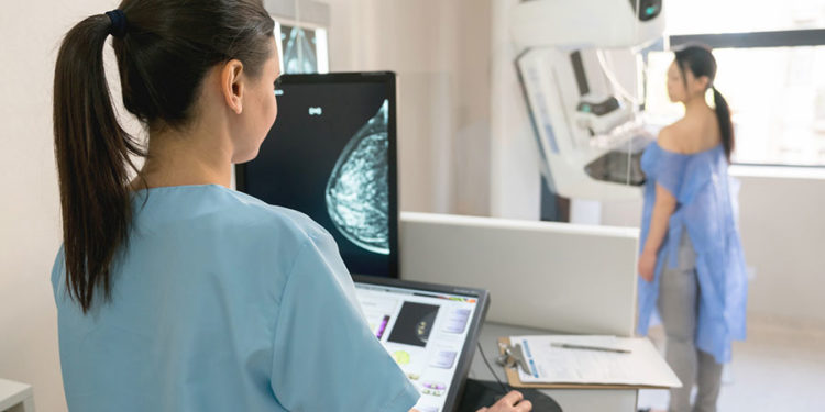 Menos de 35% das brasileiras acima de 45 anos fizeram mamografia este ano
