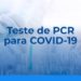 Laboratórios alertam para ameaça de desabastecimento de insumos para testes de Covid-19