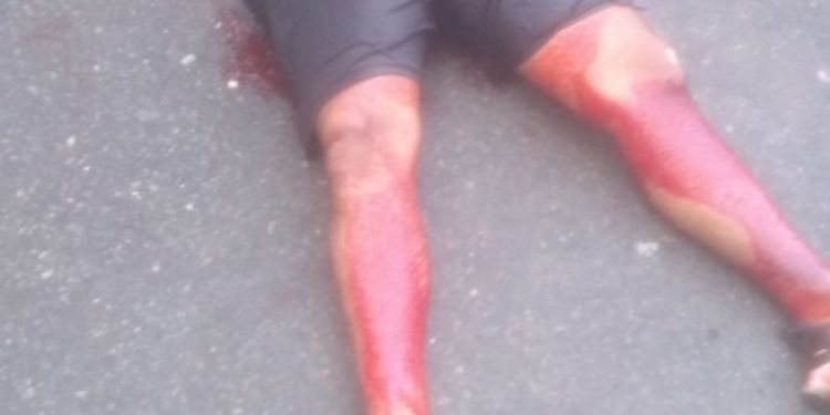 PM reage a assalto, mata bandido e fica ferido na troca de tiros