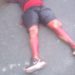PM reage a assalto, mata bandido e fica ferido na troca de tiros