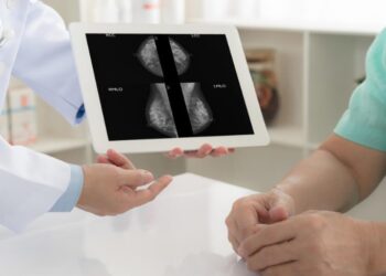 Incidência de câncer de mama em pacientes jovens é a maior em dois anos