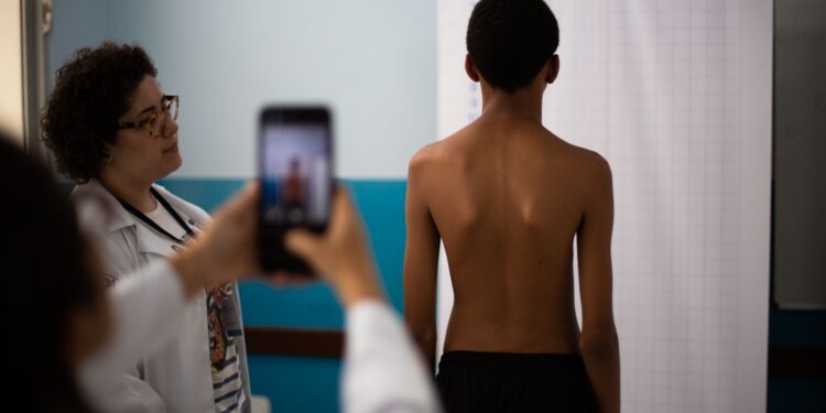 Coluna Reta: Projeto promove prevenção e busca ativa da escoliose em alunos de Volta Redonda