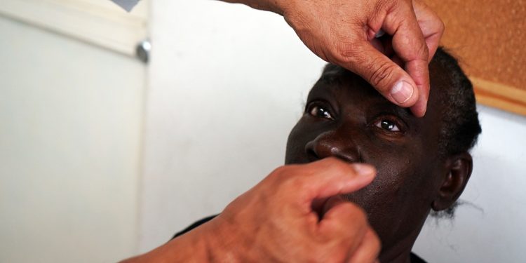 Volta Redonda oferecerá próteses oculares sob medida para pacientes do Sul Fluminense