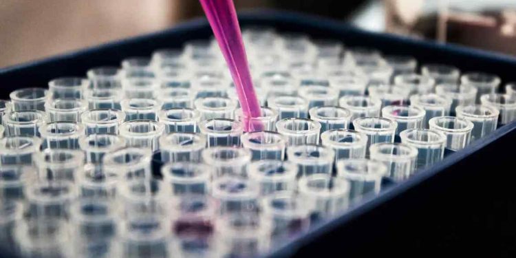 Diagnóstico de Alzheimer por exame de sangue avança em pesquisas no Brasil