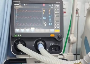 Hospital de Volta Redonda recebe quatro novos ventiladores pulmonares para UTI