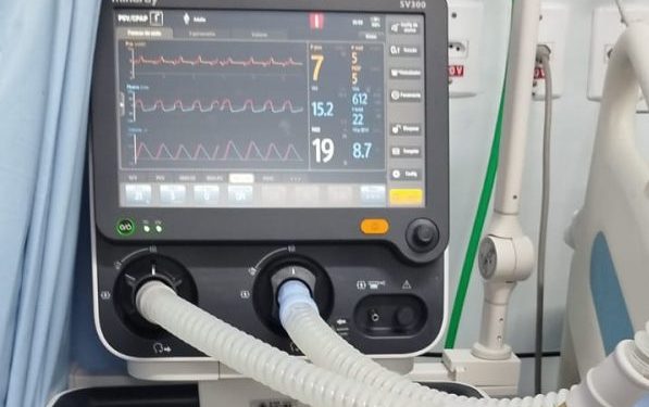 Hospital de Volta Redonda recebe quatro novos ventiladores pulmonares para UTI